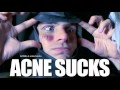 View Video