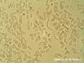 videos de Chameleon Blood Showing Live Microfilariae Parasites Part 5