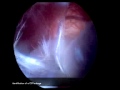 Diving Method In Neurosurgery Diving Method In Neurosurgery