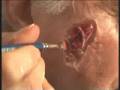 How to make a Deep Flesh Wound/Zombie Make-up