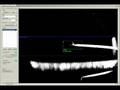 Localization of objects in the scanning electron microscope