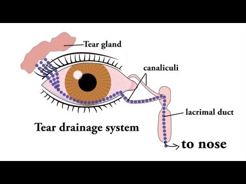 how to relieve runny eyes