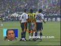 Erman ve Sansal ile Basur Yorumu