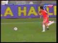 Cisse leg break
