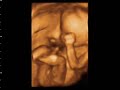 19 semanas 19 semanas