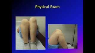 Limb Length Discrepancy (LLD) (limb length inequality)