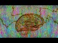 New Study: Electric Shocks to Brain Improve Memory
