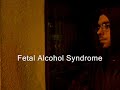 fetal alchohol syndrome