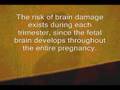 fetal alchohol syndrome