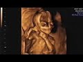 3D (4D) Ultrasound Baby Boy 19/20 Weeks