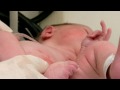 Diaper Rash - Prevention