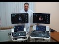Нажмите для просмотра : Видеообзор ультразвуковой системы Mindray DC-80 X-Insight