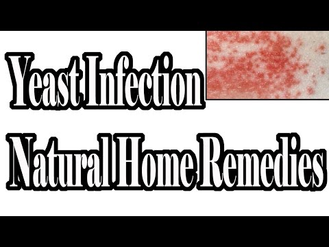 how to treat 5 year old with yeast infection