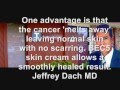 Skin cancer SOLVED, home based treatment, Curaderm-BEC5