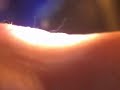 Morgellons Nano Fibers at 10x magnification