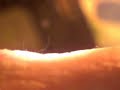 Morgellons Nano Fibers at 10x magnification