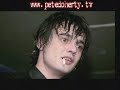 David Bennett\ David Bennett\