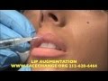 LIP AUGMENTATION AND ENLARGEMENT