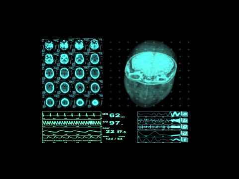 Brain Damage and Other Effects from Alcohol