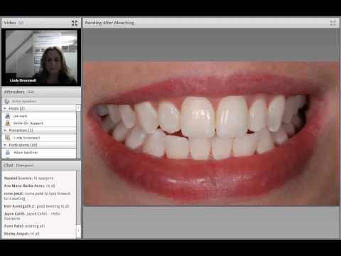 how to whiten composite bonding