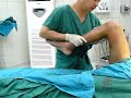 Knee manipulation knee stiffness ?????????? ?????????? ???????????