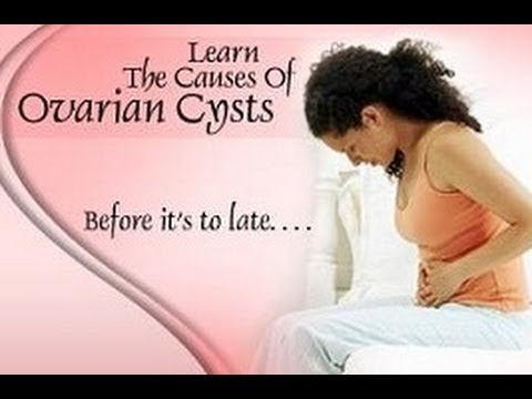 how to treat polycystic ovaries