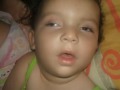 Giovanna linda MINHA PRINCESINHA (TAY-SACHS)