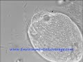 Free Swimming Ciliates