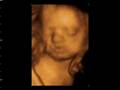 Window to the womb 4D baby scan of Lyndsey & Derek