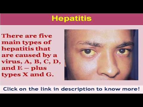 how to cure hepatitis b naturally