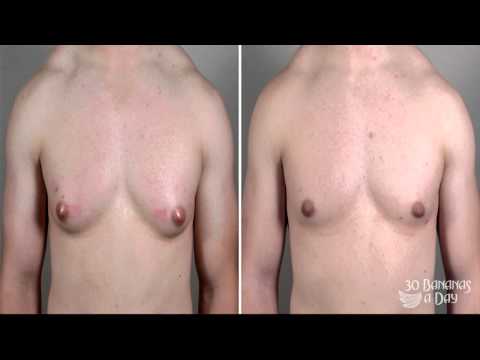 how to remove estrogen