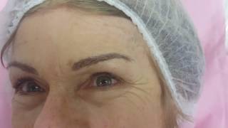 Mature Skin Microblading