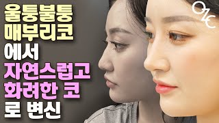 앤플러스성형외과