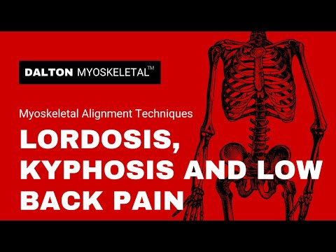 how to cure kyphosis and lordosis