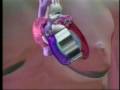 artificial heart animation