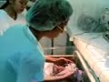 nursing: cord care demo