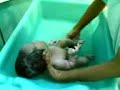 NURSING: Cord Care Demo