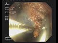 LAPAROSCOPIA ASL TO 2 S.G. BOSCO