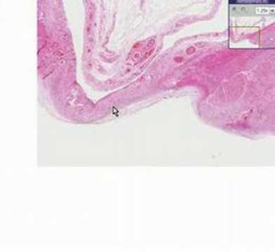 Histopathology Small intestine, ...