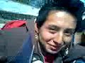 ray torcido