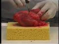 Watch an Autopsy via Videoconference