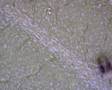 Spider Mite Urinates