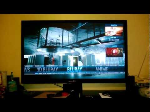 how to xbmc skin editor