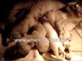 ringworm Ringworm Infection