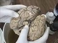 Cerebro