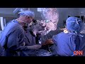 Awake patient reads aloud during brain surgery