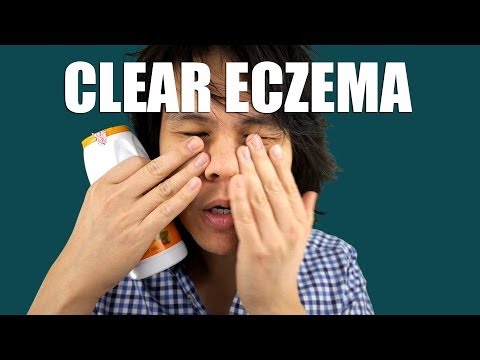 how to reduce eczema flare ups