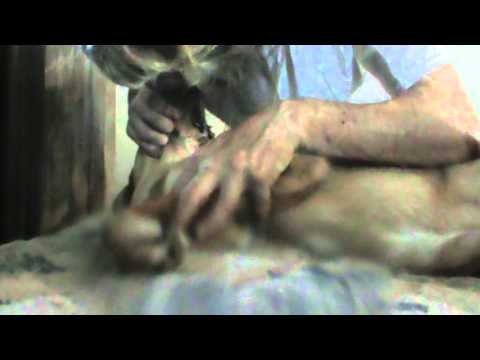 how to remove quills from a dog
