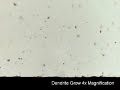 Micrograph Growing Copper Dendrites (Dendrite)