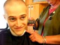 Lucas grabeel getting bald